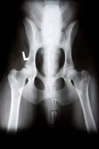 west chester Digital X-Rays